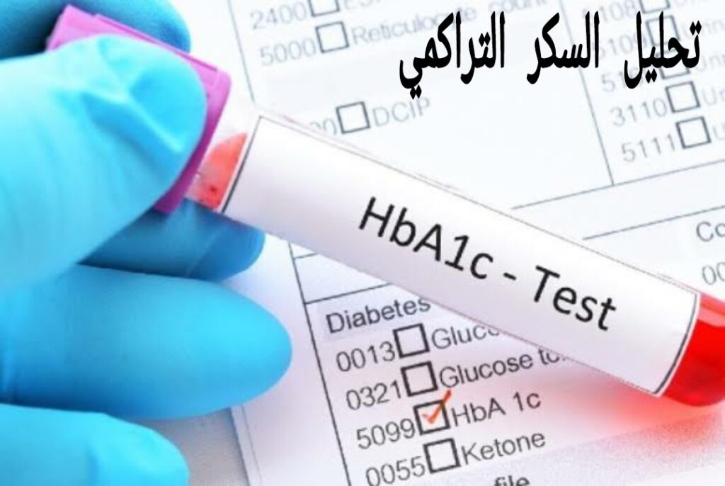 تحليل السكر التراكمي صائم أم فاطر